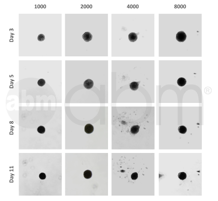T0539 immortalized human cardiomyocytes spheroid data
