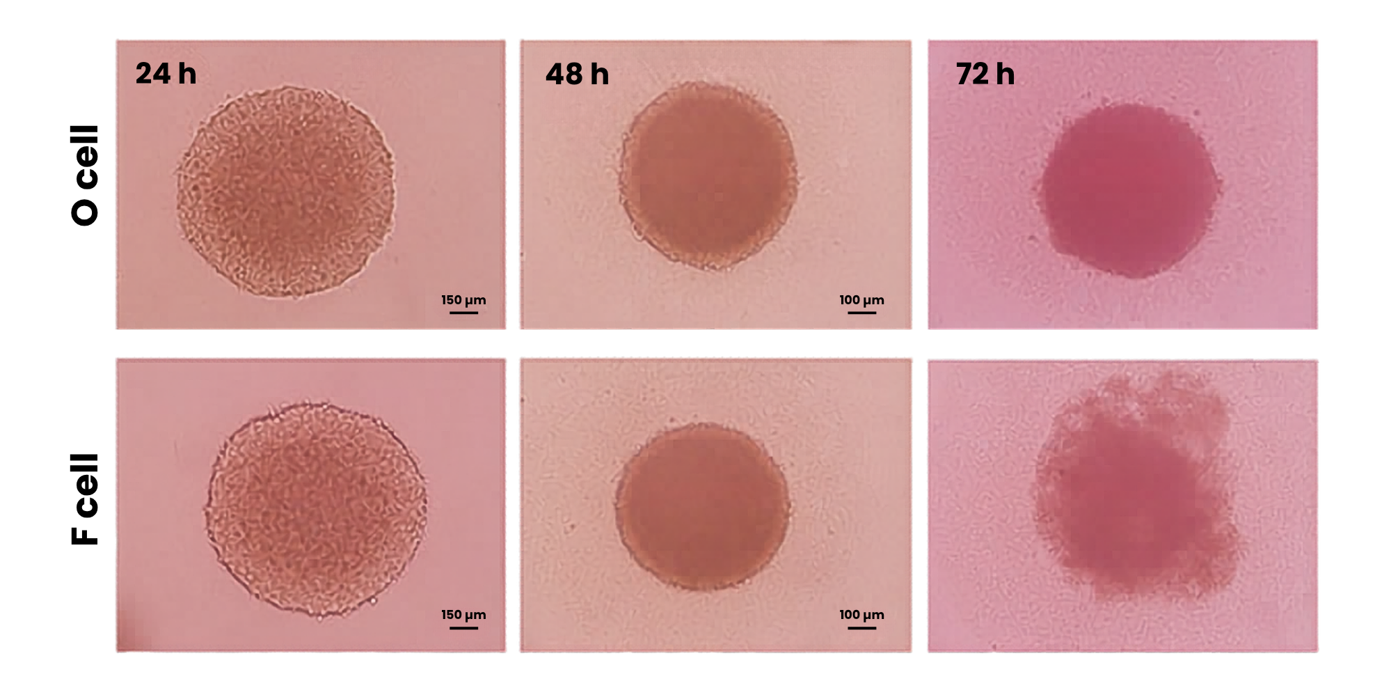 3D spheroid culture comparison between occipital and frontal dermal papilla cell lines