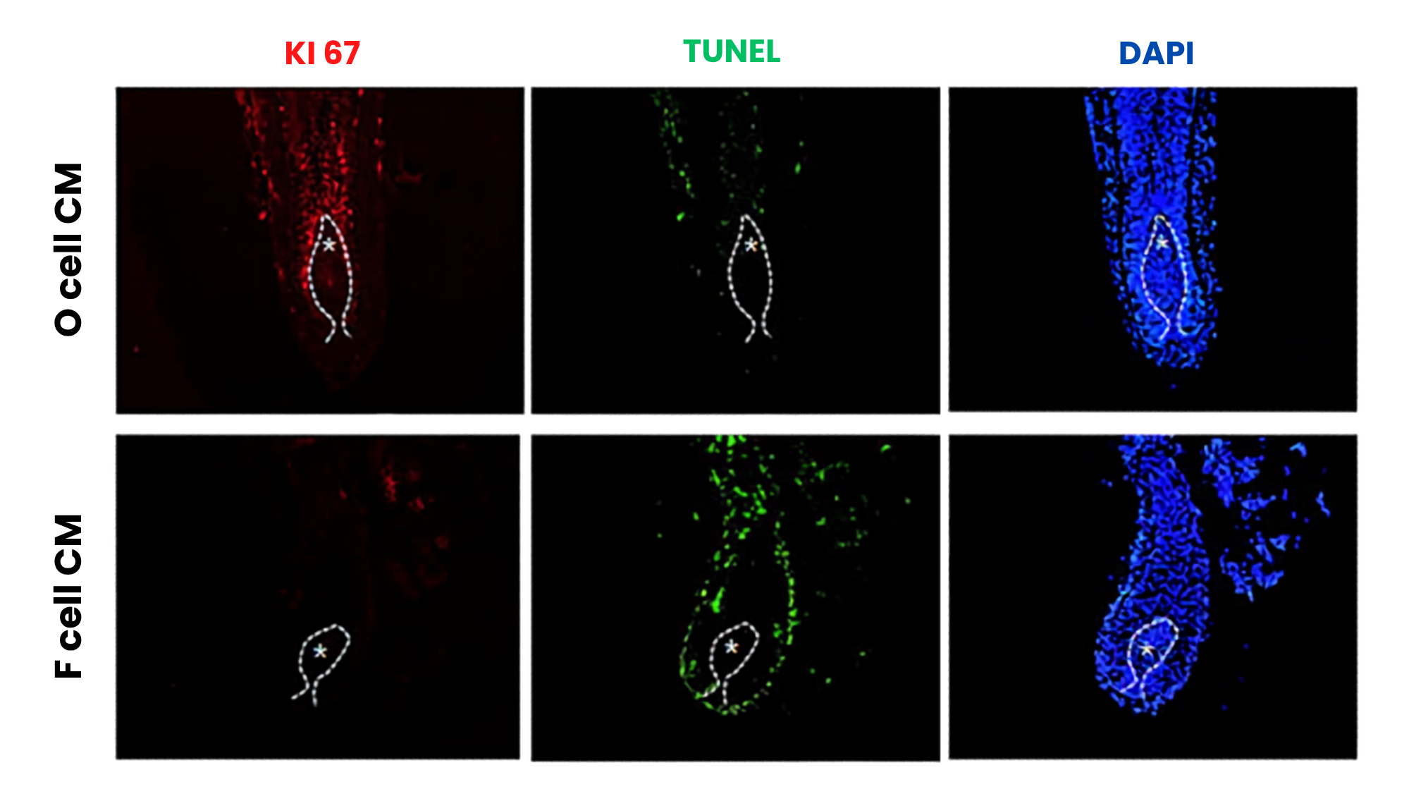 Immunostaining analysis comparing conditioned media effects from occipital and frontal dermal papilla cells
