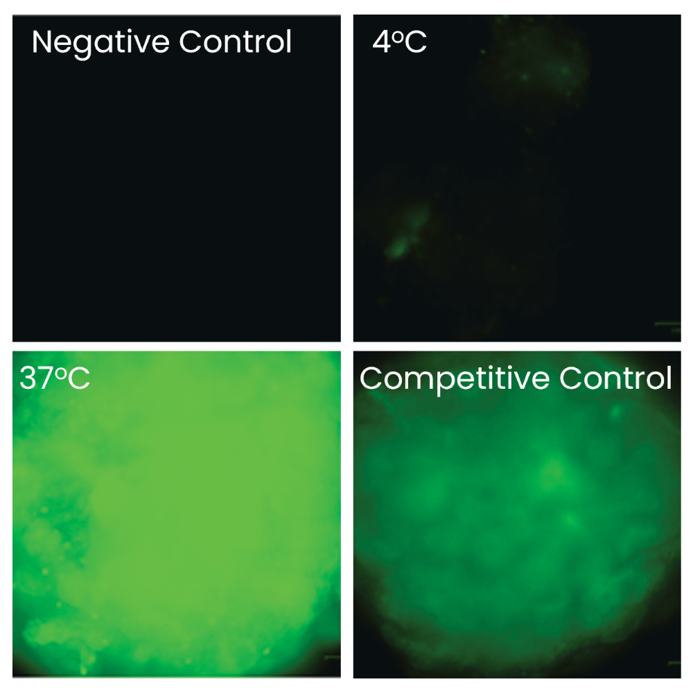 2-NBDG glucose uptake assay panel with negative control, 4 degrees Celsius, 37 degrees Celsius, and competitive control