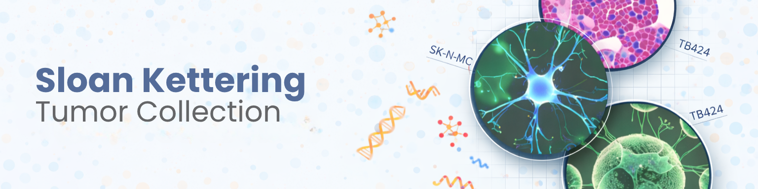Sloan Kettering Tumor Collection