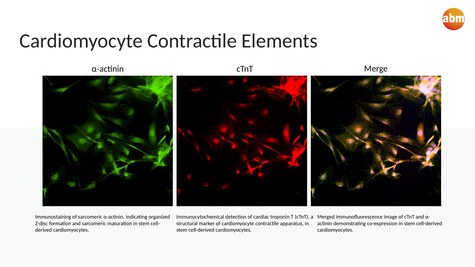 Immunocytochemistry panel showing cTnT, alpha-actinin, and merged cardiomyocyte marker staining