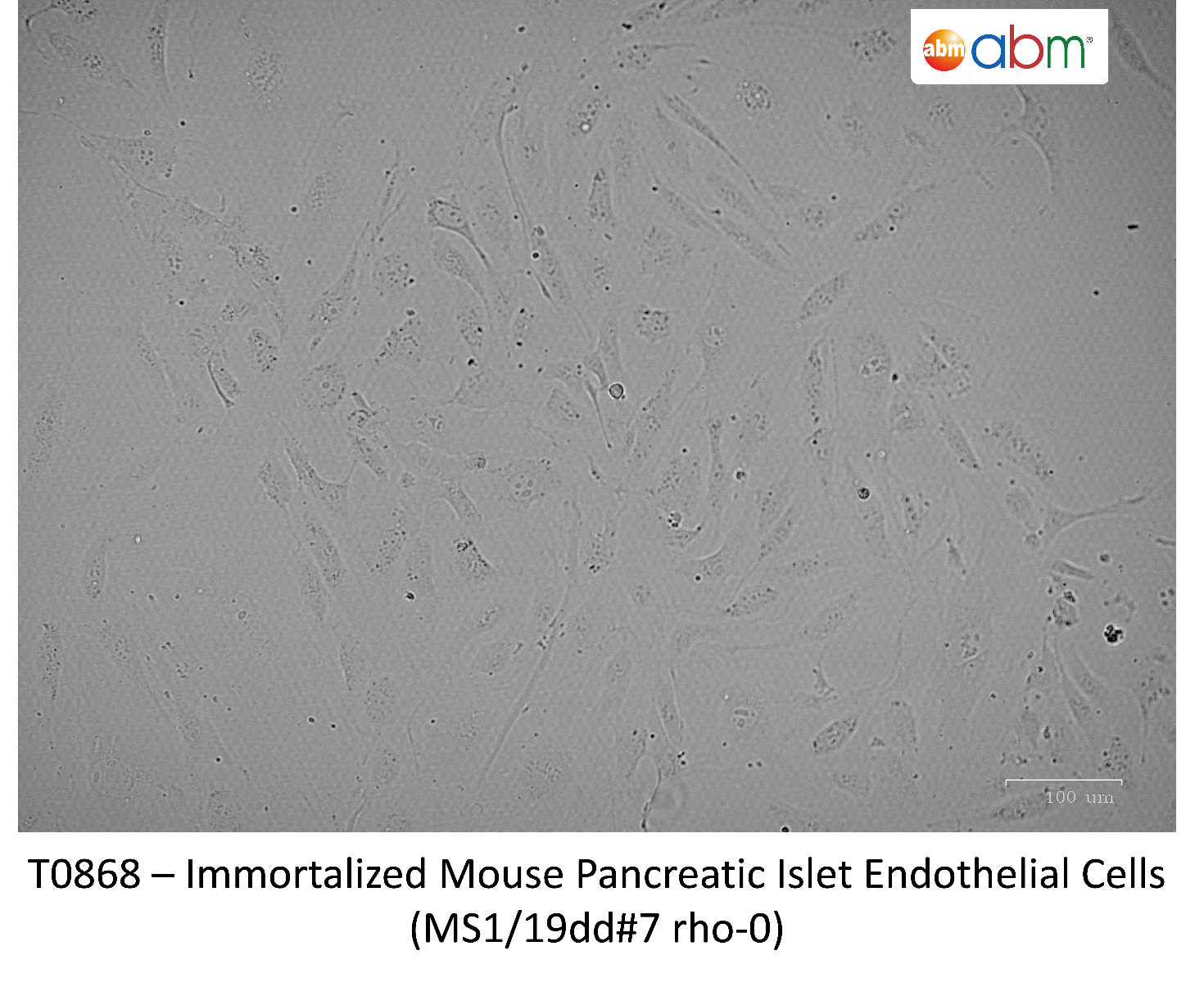 Immortalized Mouse Pancreatic Islet Endothelial Cells (MS1/19dd#7 rho-0 ...