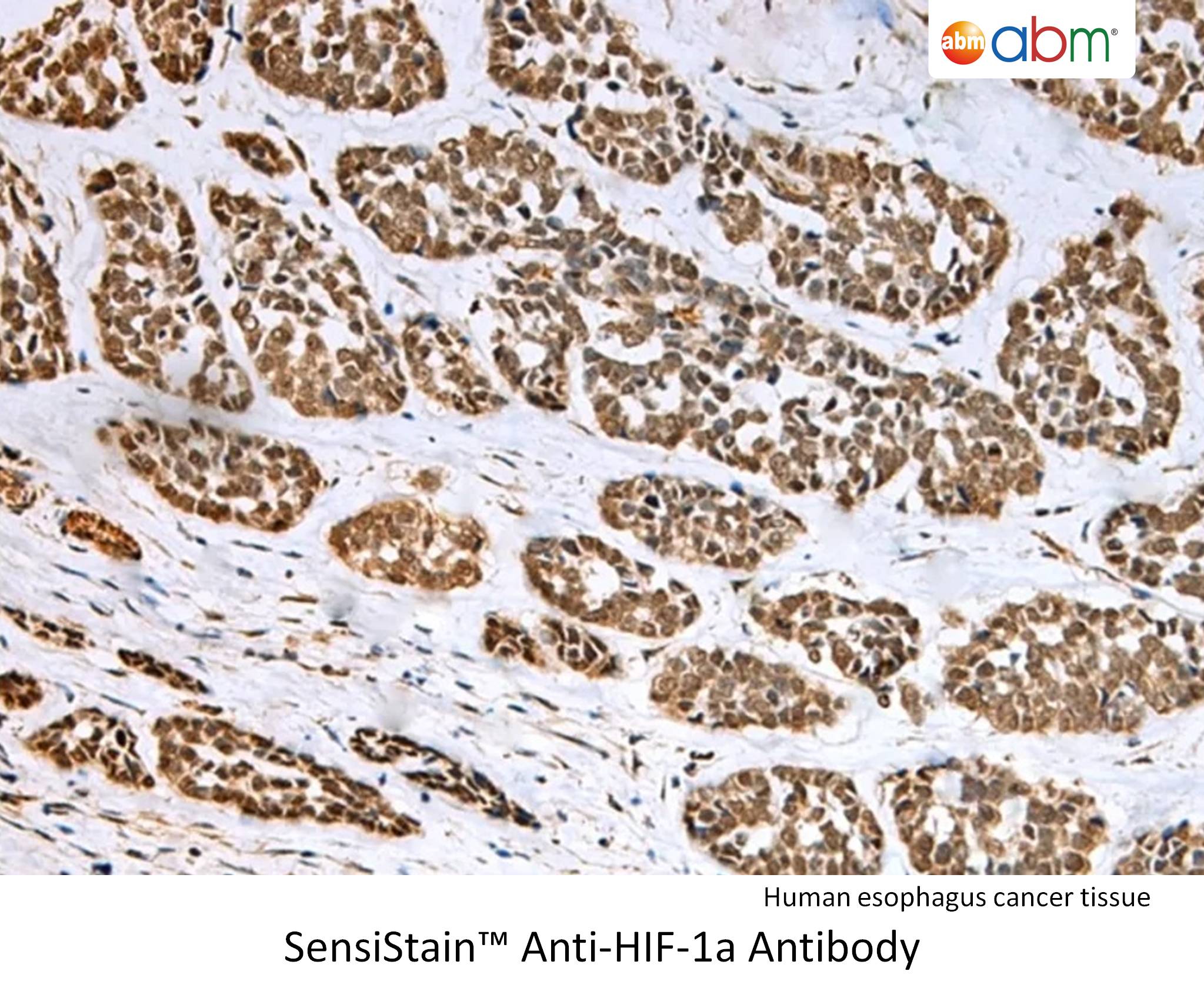 SensiStain™ Anti-HIF-1a Antibody | Applied Biological Materials Inc.